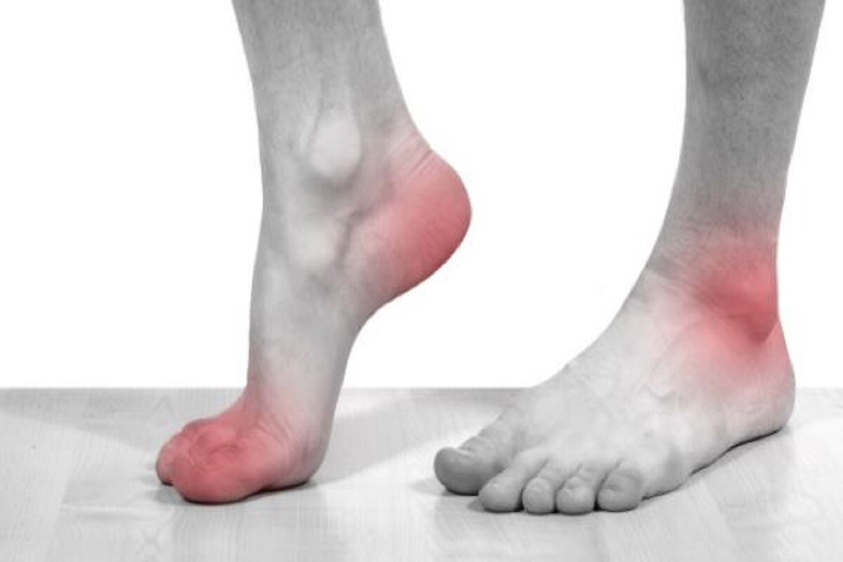 হাত ও পায়ের গোড়ালী ব্যাথা